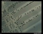 bordetella pertussis on charcoal agar